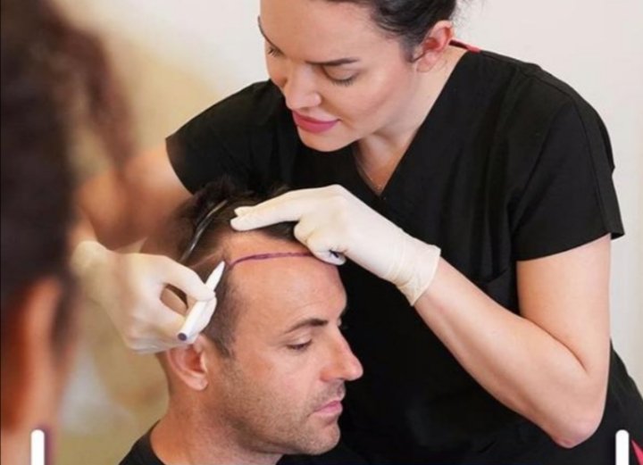 مركز Estepera واحدث تقنيات زراعة الشعر العالمية