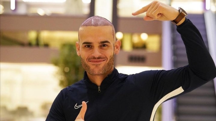 مركز Estepera يتصدر القائمة الاولى في زراعة الشعر في تركيا