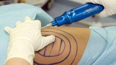 دكتور التجميل اللبناني علي عبد علي يتطرّق الى عملية شفط الدهون