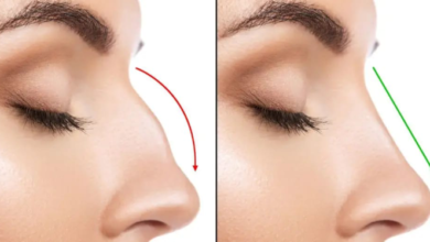 دكتور التجميل “Ali Abedali” يتحدث عن عمليات تجميل الأنف