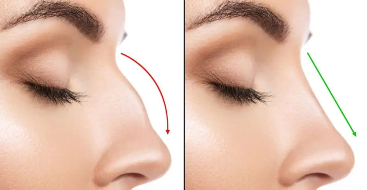 دكتور التجميل “Ali Abedali” يتحدث عن عمليات تجميل الأنف