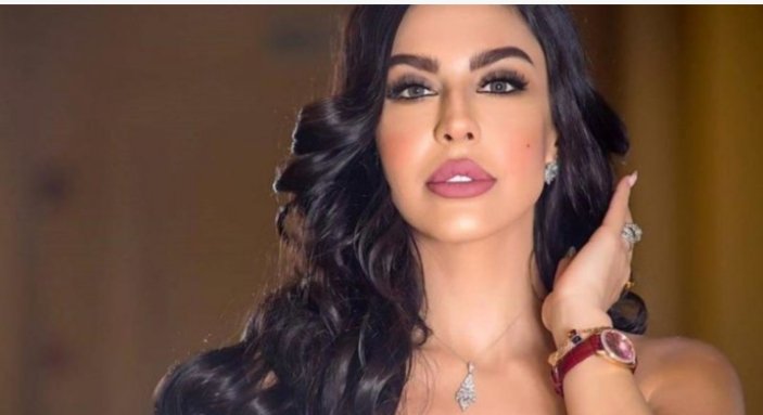 ليلى اسكندر تصدم المتابعين وتظهر بكدمات على وجهها فهل تعرضت للضرب؟