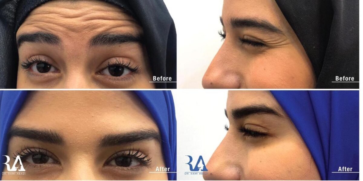لقاء خاص مع دكتور الأمراض الجلديَّة والتّجميل رامي عبادي