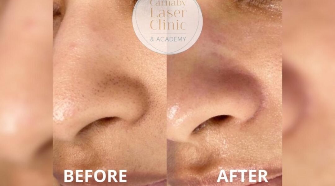 مركز “Carnaby Laser Clinic and Academy” يُقدم التقنية الأفضل لبشرة نضرة ومتوهجة