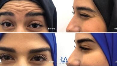 لقاء خاص مع دكتور الأمراض الجلديَّة والتّجميل رامي عبادي