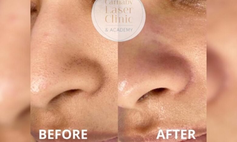 مركز “Carnaby Laser Clinic and Academy” يُقدم التقنية الأفضل لبشرة نضرة ومتوهجة