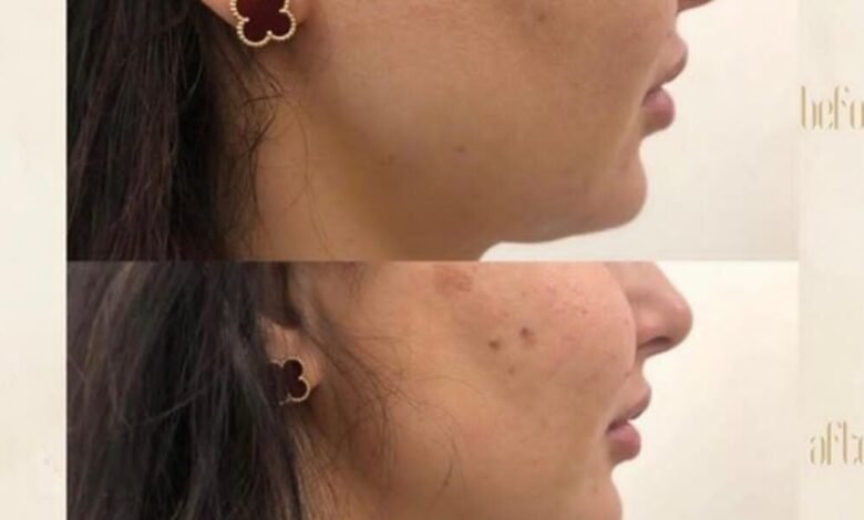 مركز “Dermanda Clinic” التجميلي ريادة في تقديم العلاجات الآمنة للمشاكل الجلدية