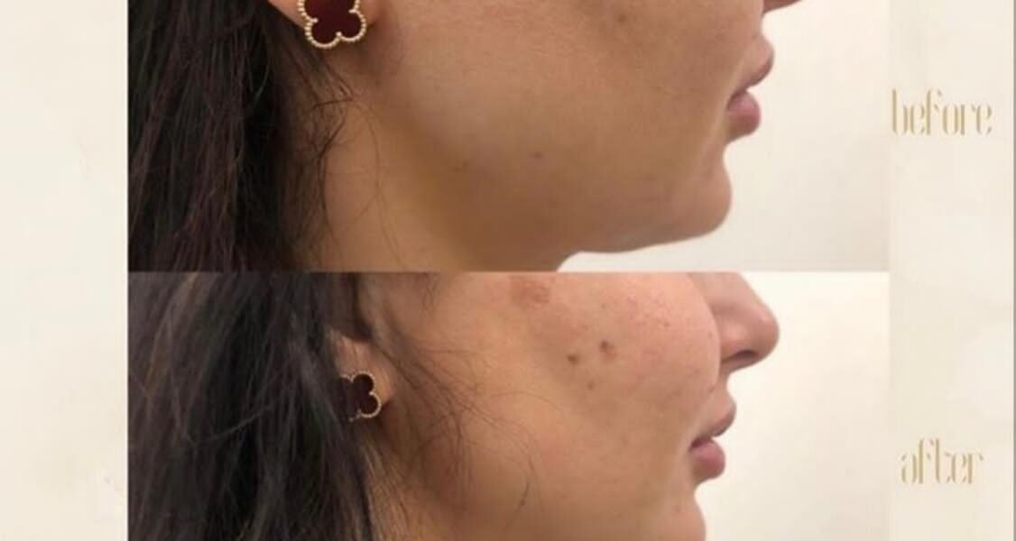مركز “Dermanda Clinic” التجميلي ريادة في تقديم العلاجات الآمنة للمشاكل الجلدية